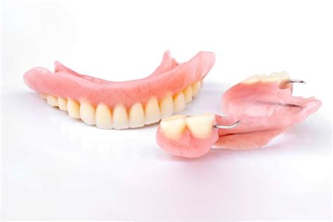 Pros and Cons of Flexible Partial Dentures | Mesa Dentist