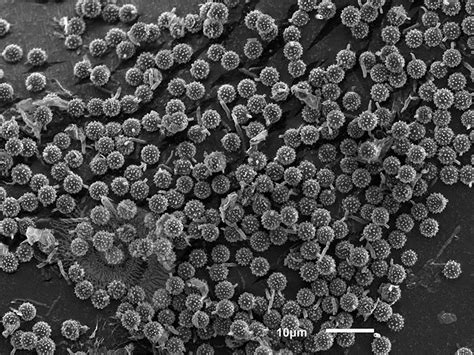 Puffball Spores - Lichen Labs