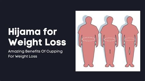 Hijama for Weight Loss - Benefits and Side Effects - Cup Cure