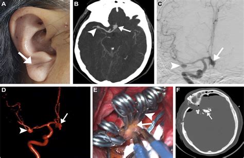 Neurosurgery Practice