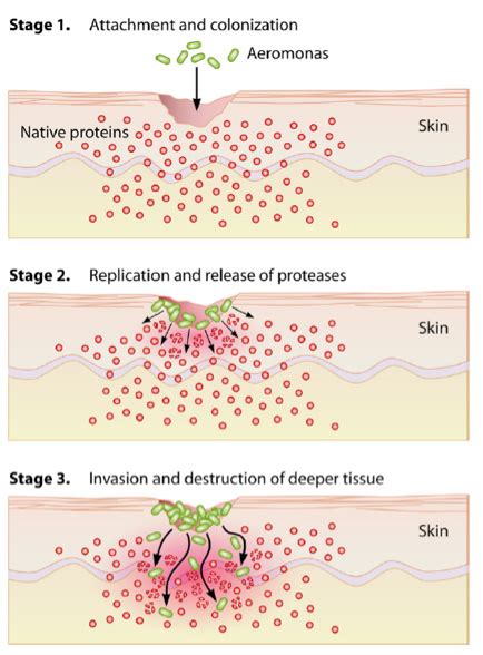 Aeromonas Antigens - Creative Diagnostics