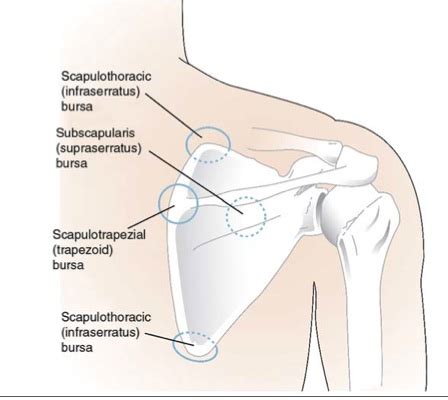 Scapulothoracic Crepitus - Shoulder & Elbow - Orthobullets