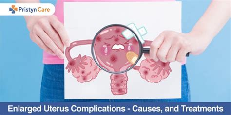 Enlarged Uterus Complications - Causes, and Treatments - Pristyn Care