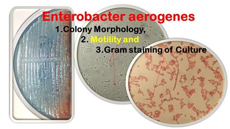 Enterobacter Aerogenes Gram Stain