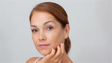 Sun Spots in Midland, TX | Basin Dermatology