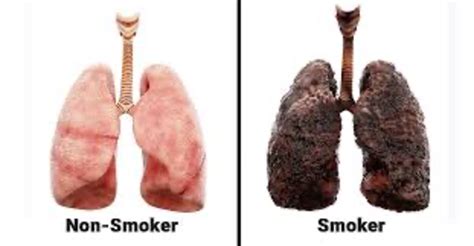 The Effects of Smoking and Vaping on the Respiratory System | elink