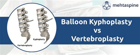 Kyphoplasty and Vertebroplasty | Mehta Spine