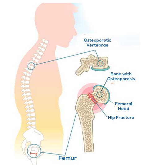 Chronic Back Pain Treatment in Ludhiana, Punjab | Hunjan Super ...