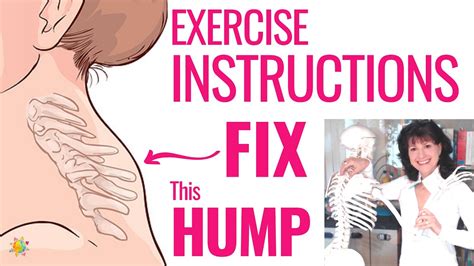 List Of How To Fix Hump Neck Reddit Ideas - Upgreen