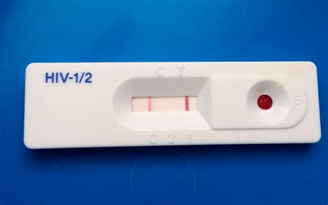 Types of HIV test - HIVinDV