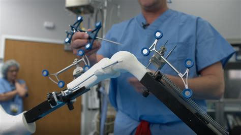 LewisGale using robotics-assisted knee surgery | WSET