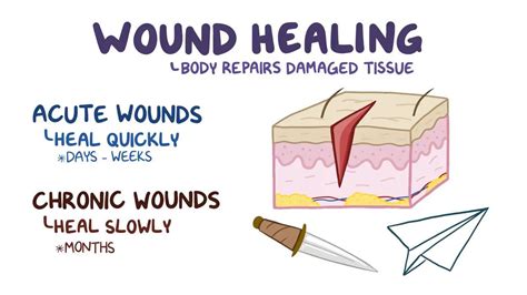 Wound Healing Diagram