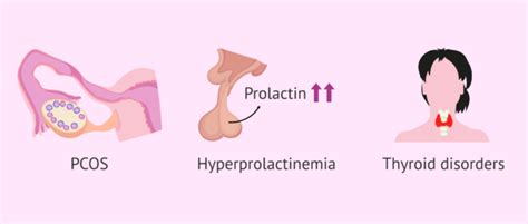 Anovulation due to hormonal alterations