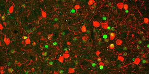 MIT neuroscientists build case for new theory of memory formation ...