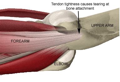 Picture Of Forearm Tendons / (1) the collagen fibers are closely packed ...