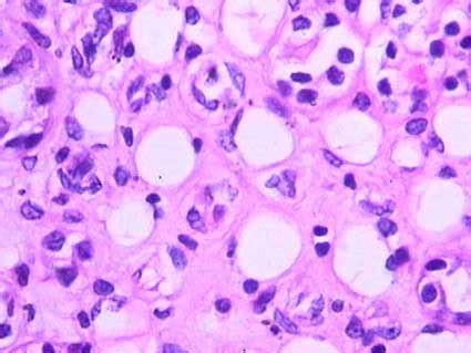 Interstitial Cells Histology