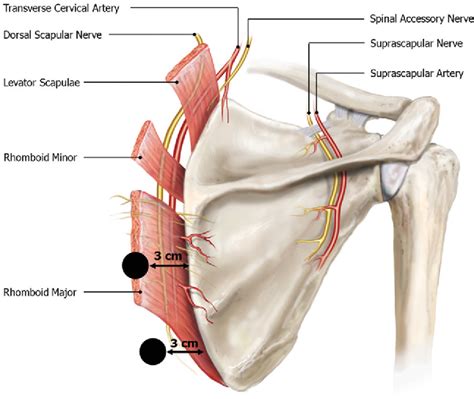 Table 1 from Scapulothoracic Bursitis and Snapping Scapula Syndrome | Semantic Scholar