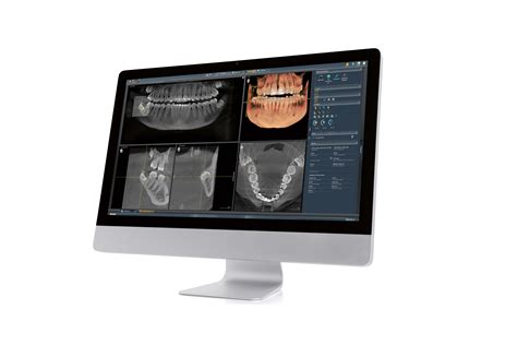 SIDEXIS_4_integration – A.R. Wynnykiw, DDS, PLLC