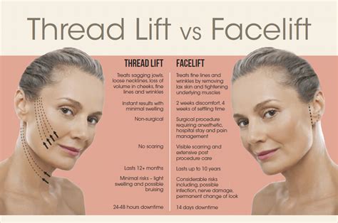 Thread Lift in Malaysia: Procedures, Prices, Side Effects, Aftercare & More