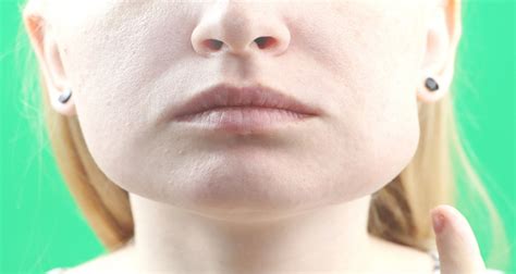 Swollen Cheeks: 4 Proven Causes Why It Happens