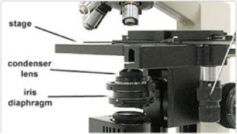 Microscope World Blog: Microscope Condenser and Aperture Diaphragm