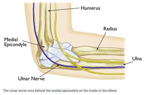 Cubital Tunnel Syndrome – Carolyn Yang, MD