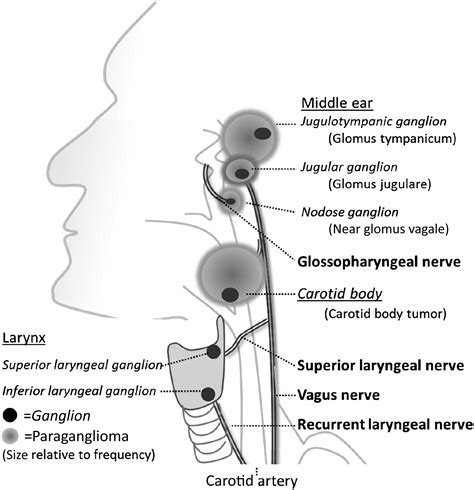 Paragangliomas Arising in the Head and Neck - Surgical Pathology Clinics