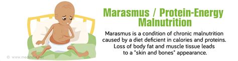 Marasmus | Protein-Energy Malnutrition - Causes, Symptoms, Diagnosis, Treatment and Prevention