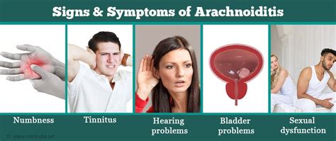 Arachnoiditis - Types, Causes, Symptoms, Risk Factors, Diagnosis ...