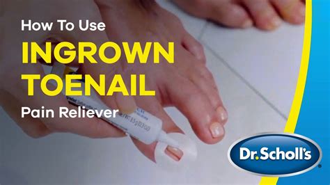 Ingrown Toenail Treatment Pain Relief Scholl's | lupon.gov.ph