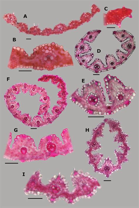 Leaf blade anatomy in transversal section of Agrostis species, in... | Download Scientific Diagram