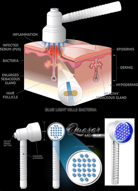 Baby Quasar Reviews: MD Blue Skincare Therapy Device