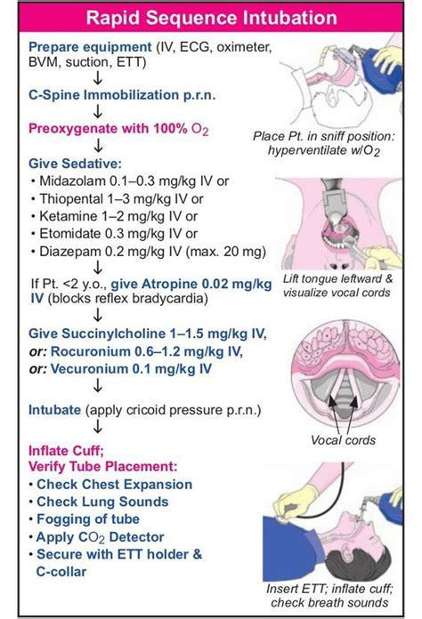 Nasotracheal Intubation Indications