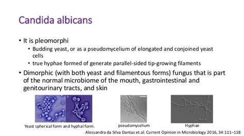 Chronic mucocutaneous candidiasis