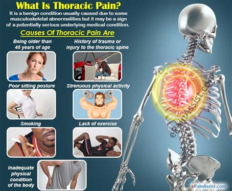 Thoracic Pain: Treatment, Causes, Symptoms, Diagnosis