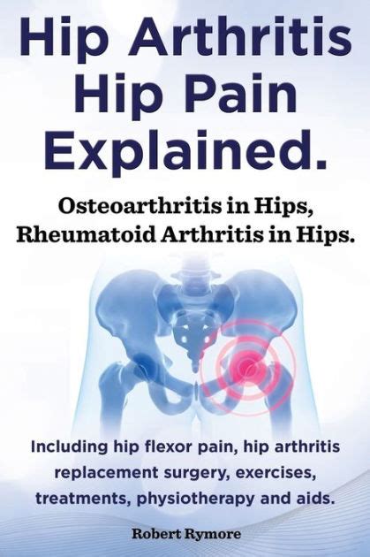 Hip Arthritis, Hip Pain Explained. Osteoarthritis in Hips, Rheumatoid ...