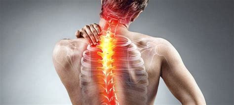 Burning Sensation in Your Back: Causes, Symptoms, Treatment - Post Oak ER