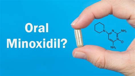 Oral Minoxidil for Hair Loss: Better than Topical? - Hairverse