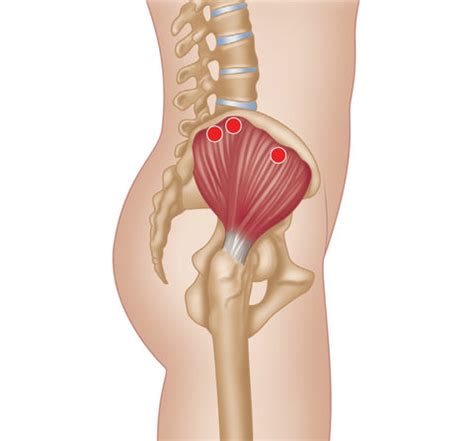 Treating Trigger Points in the Glutes – Stuart Hinds Performance Therapy