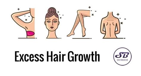 Excess hair growth? Hirsutism, can we treat it?