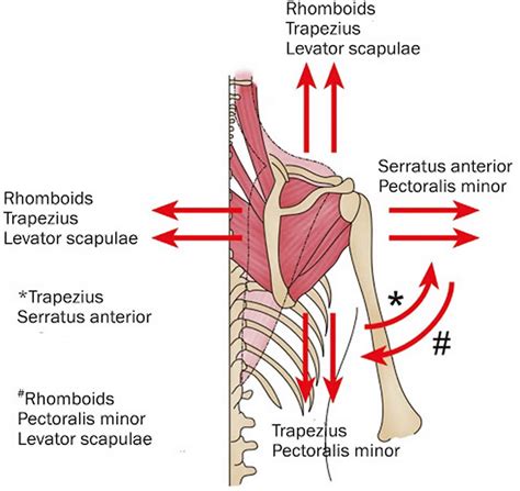 Snapping Scapula Syndrome – Non-surgical Options –, 52% OFF