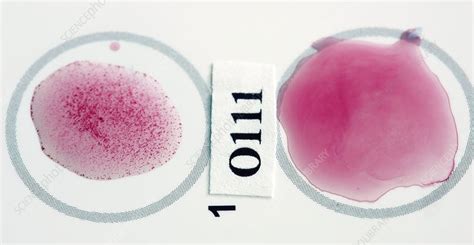 E. coli STEC bacterial test - Stock Image - C021/4963 - Science Photo ...