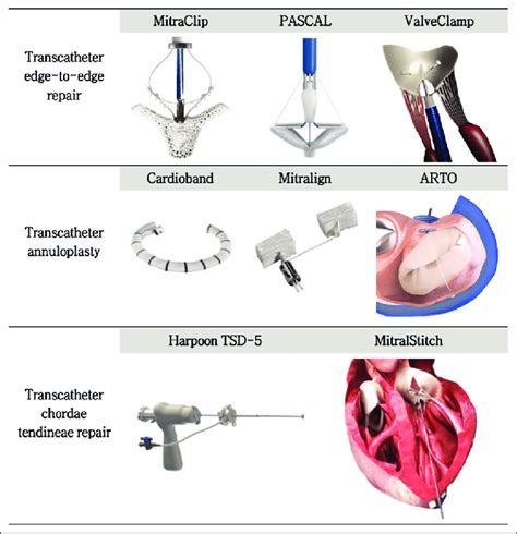 Representative TMVr technologies | Download Scientific Diagram