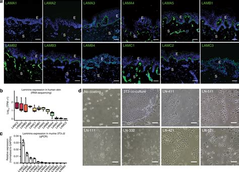 Identification of laminin chain expression in human epidermal basement... | Download Scientific ...