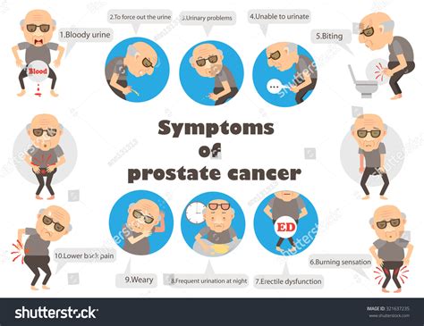 Symptoms Prostate Cancer Infographic.Vector Illustration - 321637235 ...