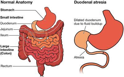 Intestine Vs Colon