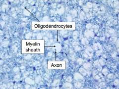 CNS and Endocrinology Histology Flashcards - Cram.com