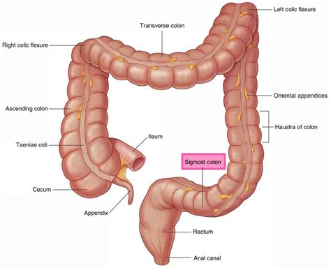 Sigmoid colon anatomy, location, function, polyps, diverticulosis & cancer