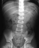 Paediatric X-Ray Tutorials
