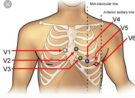 Medical Surgical Nursing, Cardiac Nursing, Nursing Study, Nursing Notes, Nursing Programs ...